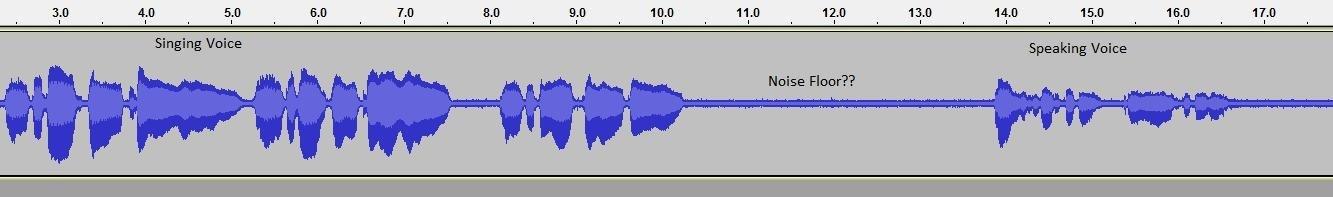 TC-Helicon VoiceTone C1 Customer Review TC-Helicon VoiceTone C1 - Customer Photo 2