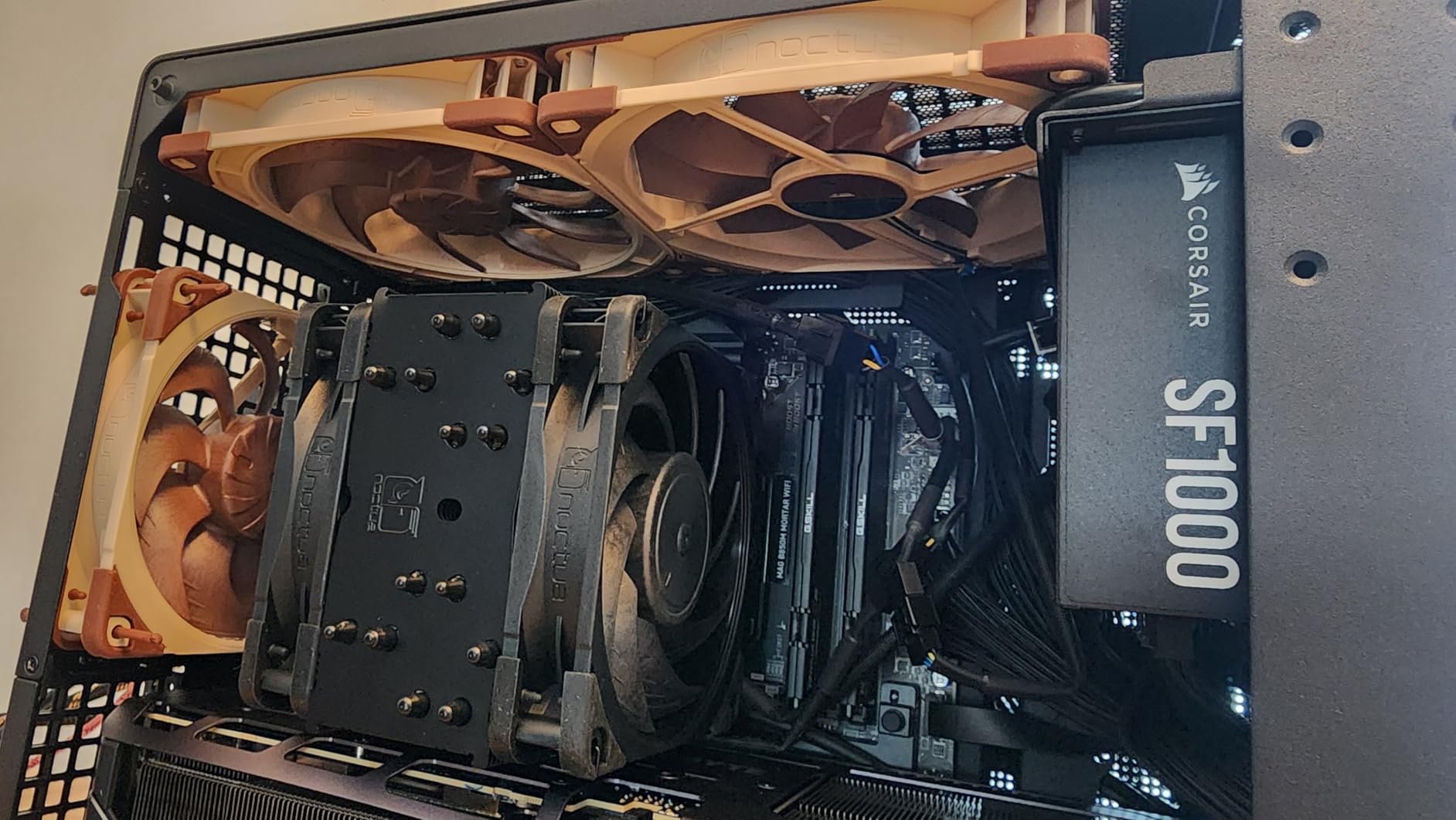 JONSBO/JONSPLUS Z20 Mesh Black Micro-ATX Mini Tower PC Case,with Detachable Carrying Handle, Mini Size, High-Performance Hardware Compatible, Support 240AIO, H160mm Cooler, Black customer photo 1