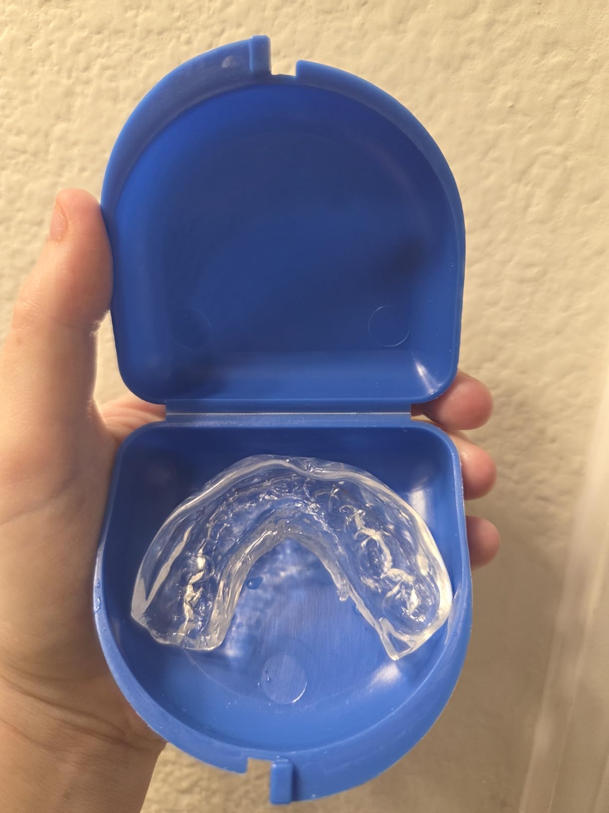 Moldable Mouth Guard for Teeth Grinding and Clenching - 6-Pack Dental Guards in 2 Sizes (4 Regular + 2 Small) - Comfortable Night Guard for Women customer photo 1