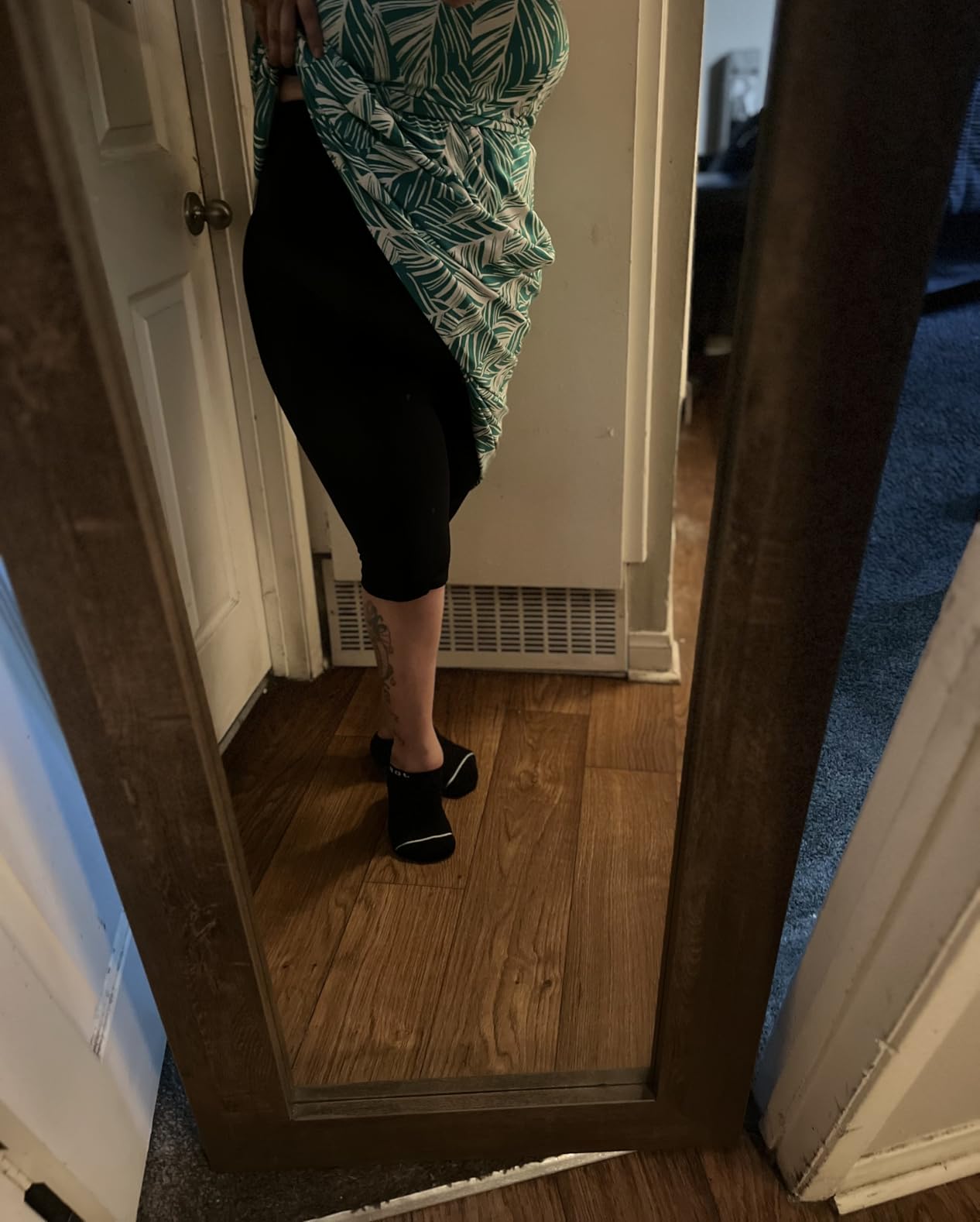 Mojo Compression Shorts 20-30mmHg, Graduated Support for Lymphedema, Lipedema & Edema customer photo 1