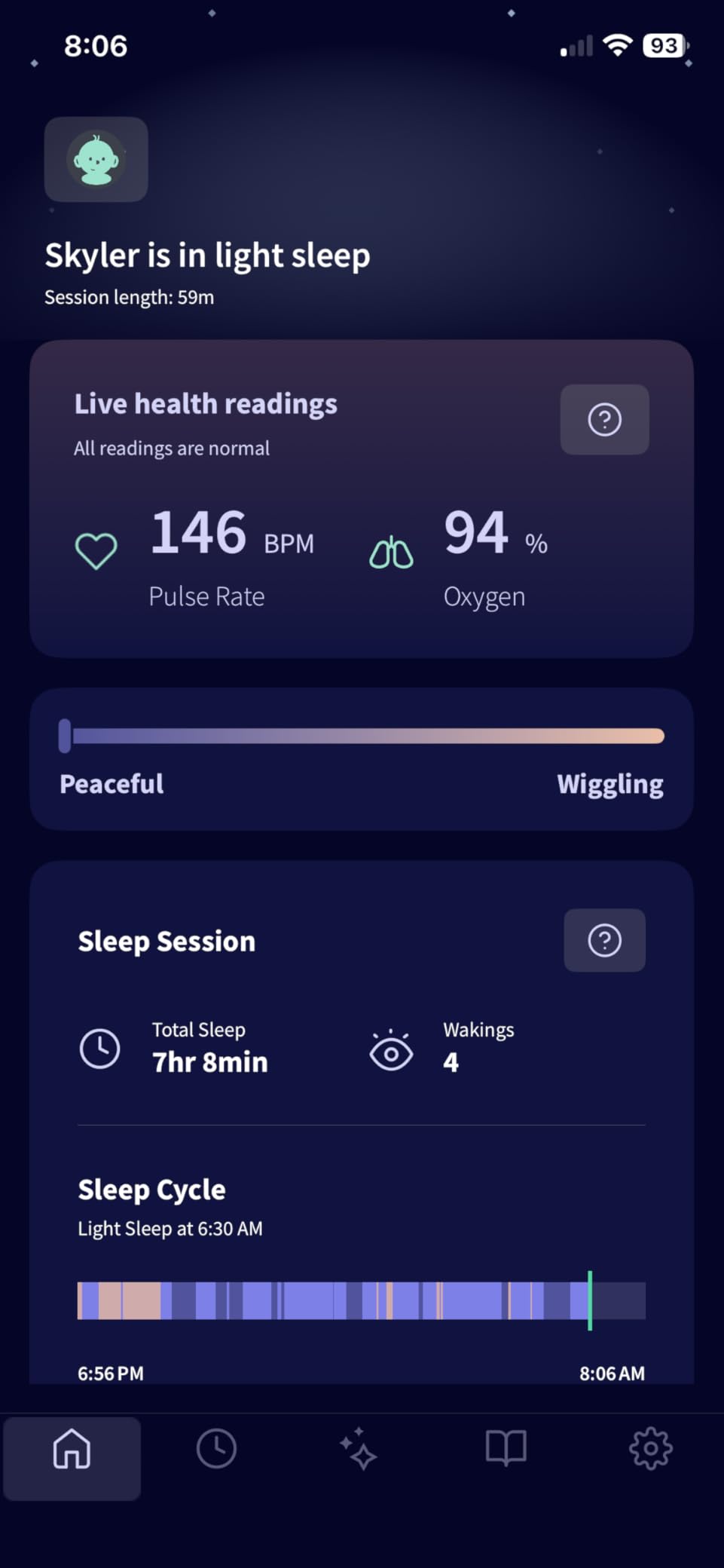 Owlet Dream Sock - Smart Baby Monitor View Heart Rate and Average Oxygen O2 as Sleep Quality Indicators, Digital Sleep Coach customer photo 1