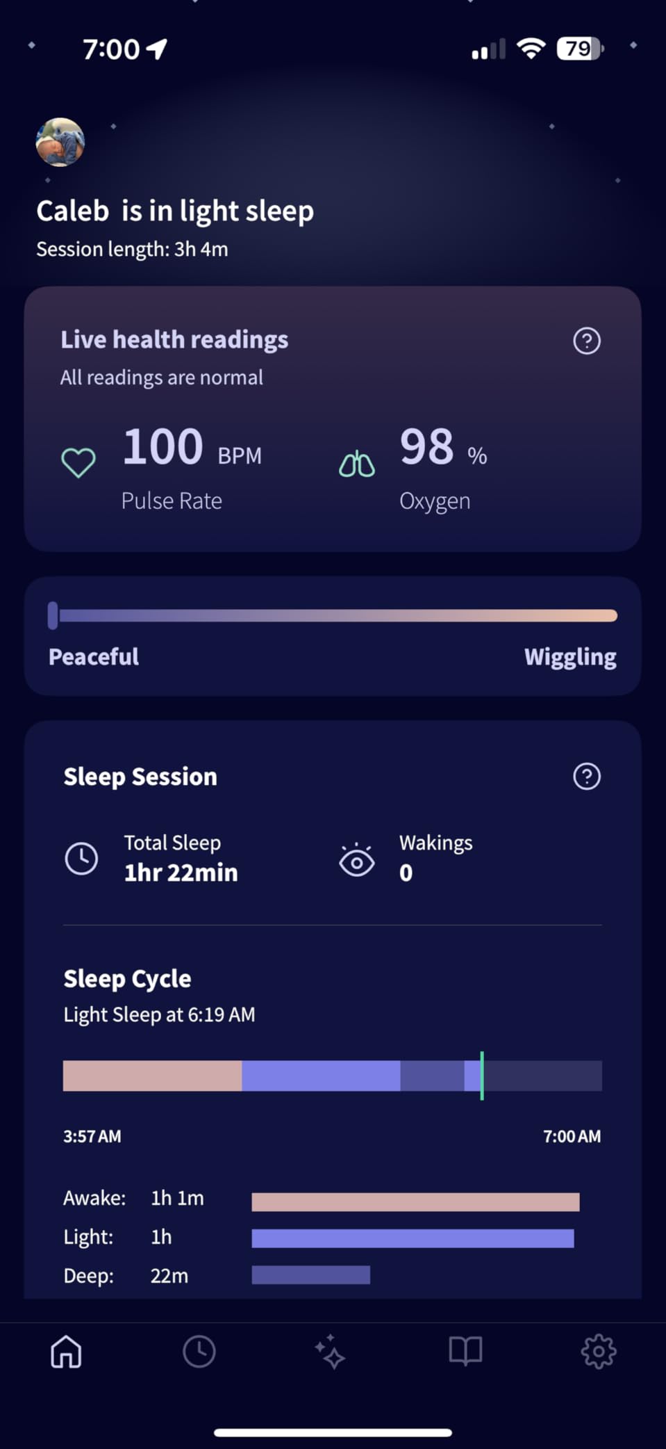 Owlet Dream Sock - Smart Baby Monitor View Heart Rate and Average Oxygen O2 as Sleep Quality Indicators, Digital Sleep Coach customer photo 2