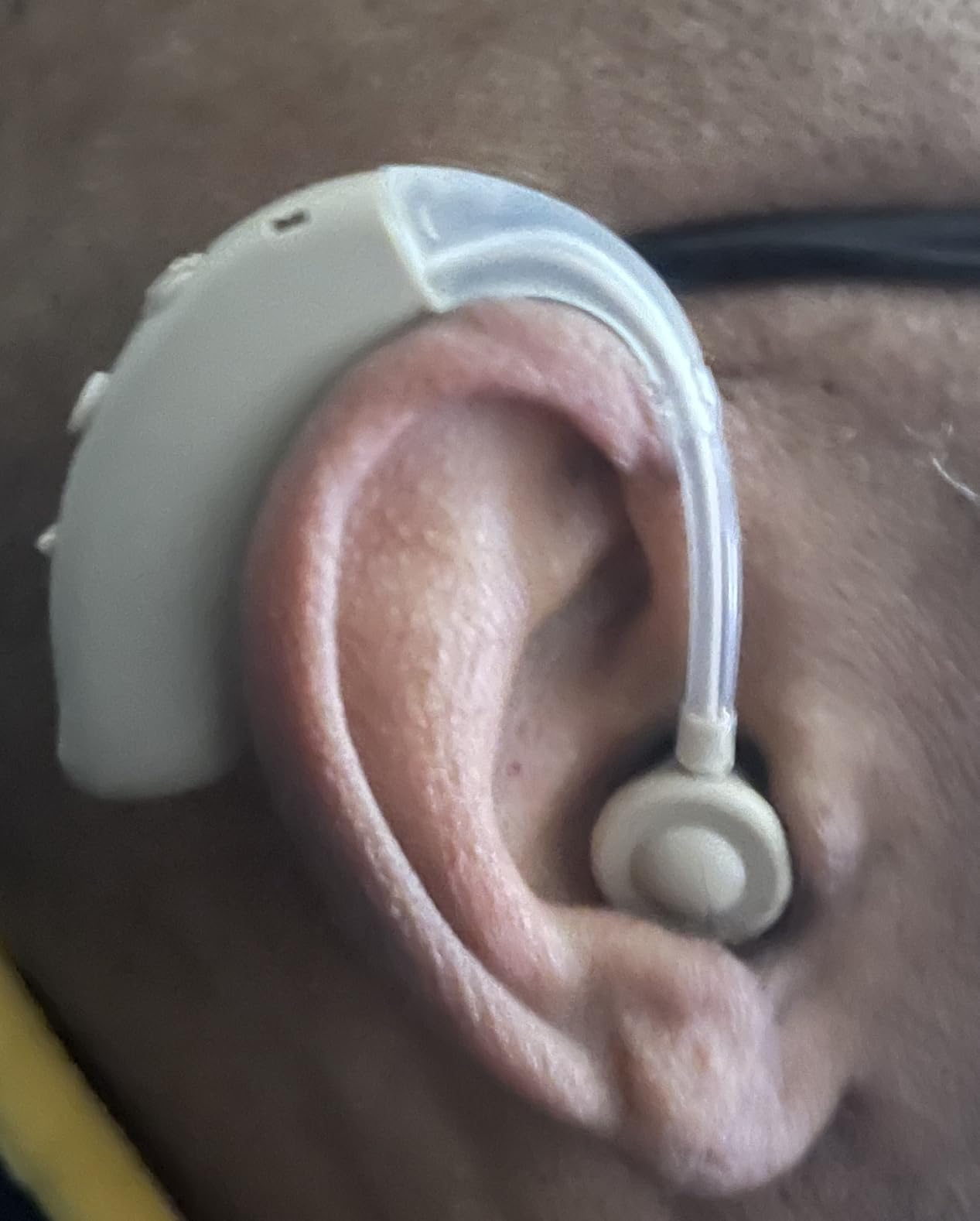 OTC Hearing Aids Rechargeable for Seniors, Lightweight Hearing Amplifiers for Adults with Intelligent Noise Reduction, Portable Behind-the-Ear Hearing Aid Headphones customer photo 1