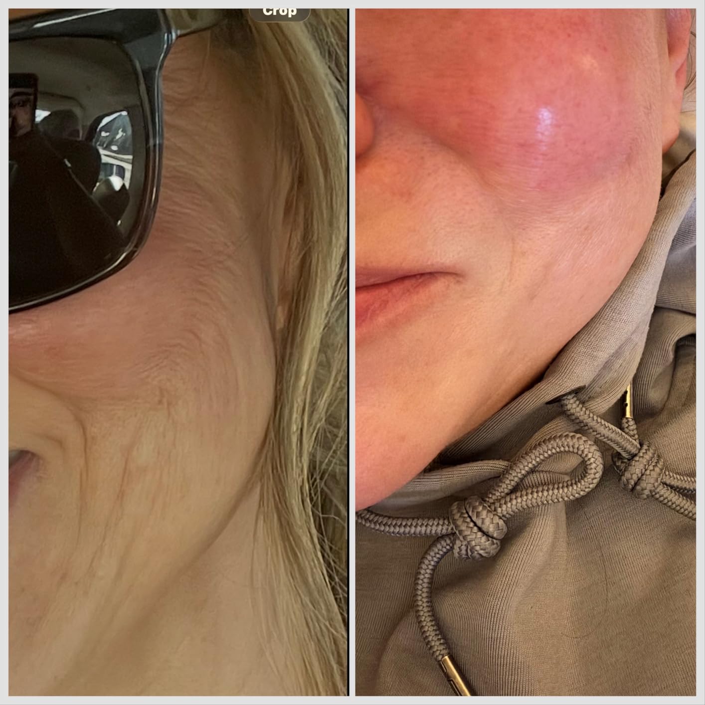 RoC Retinol Correxion Deep Wrinkle Retinol Face Serum with Ascorbic Acid, Anti-Aging Treatment for Fine Lines, Dark Spots, Post Acne Scars, 1 Oz customer photo 2