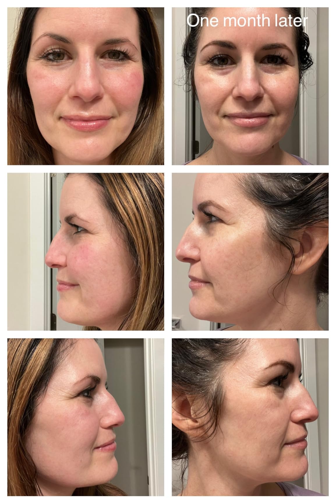 CeraVe Vitamin C Serum for Face with 10% Pure Vitamin C, Hyaluronic Acid & 3 Essential Ceramides, Skin Brightening Antioxidant Serum customer photo 2