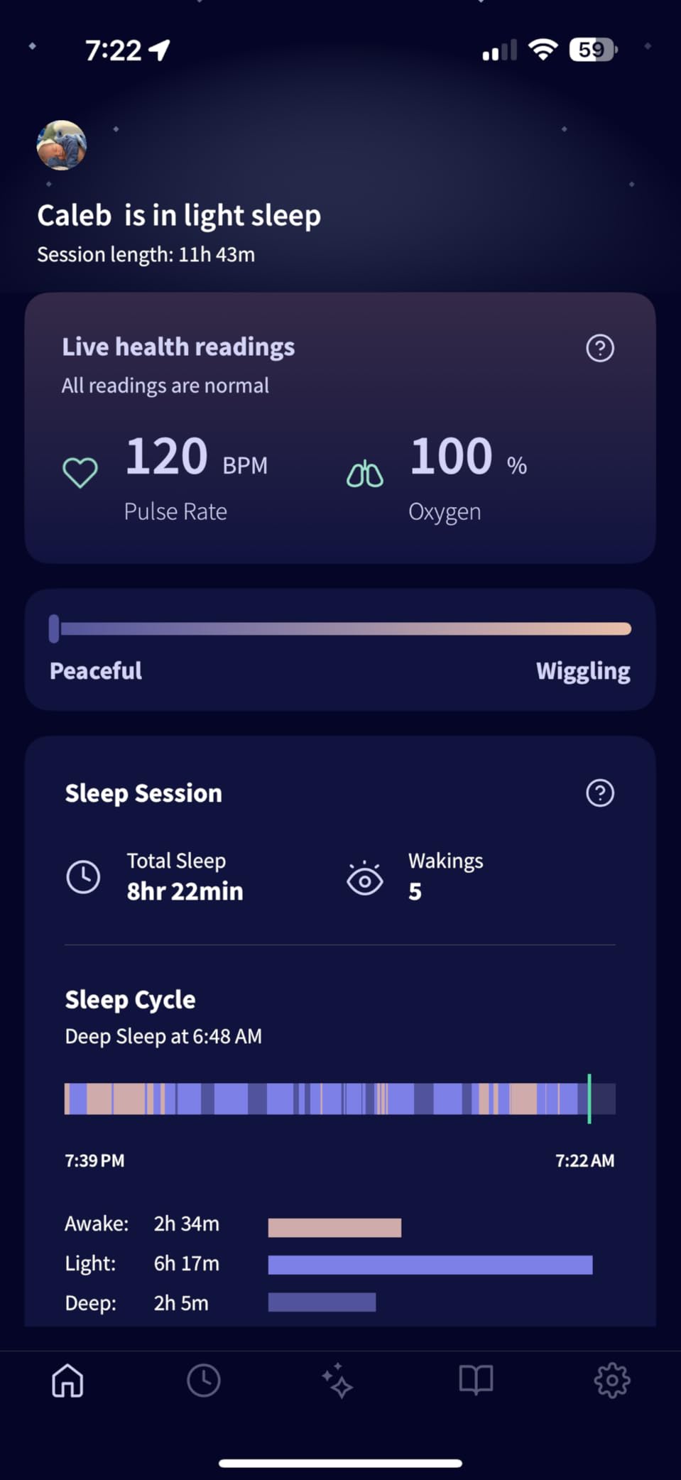 Owlet Dream Sock Smart Wearable Baby Monitor Tracks Heart Rate & Oxygen in Real Time Parents Receive Alerts, Sleep Insights & More via App - Bedtime Blue customer photo 2