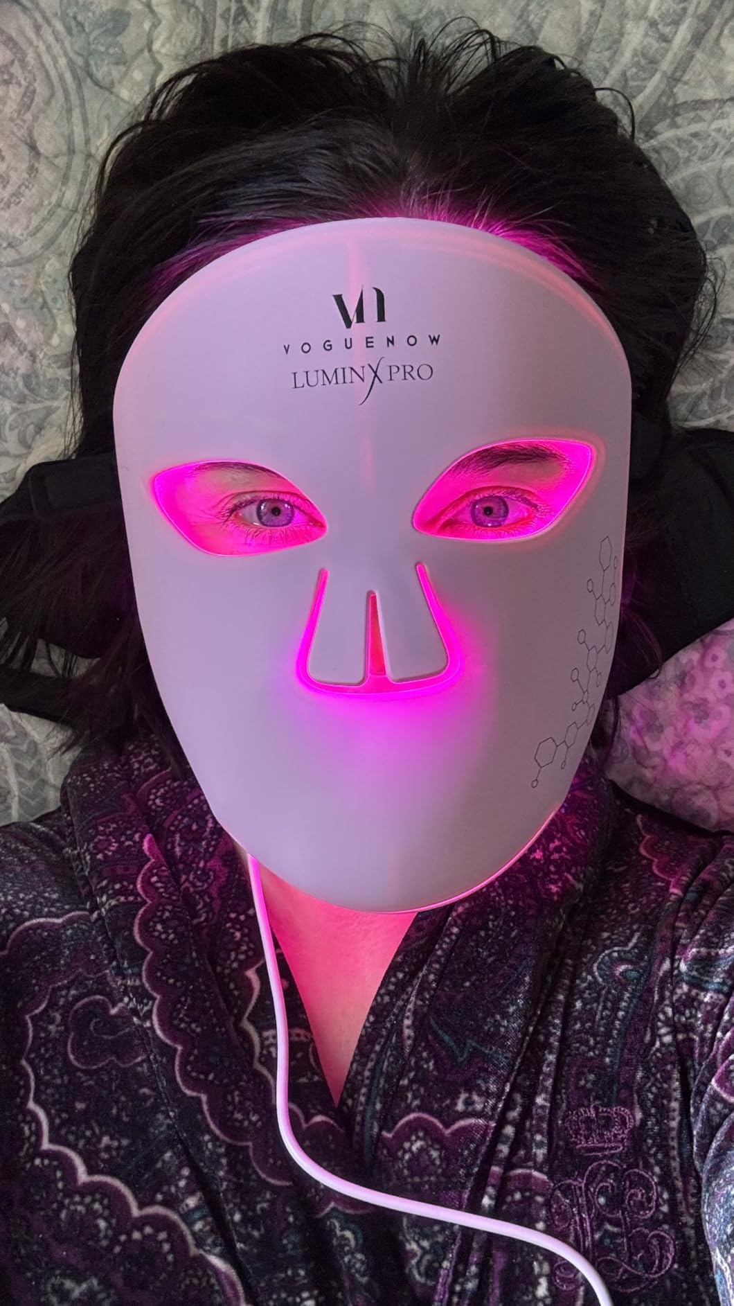 VogueNow LED Light Therapy Mask - FDA-Cleared Device for Wrinkles & Acne - Red Light Therapy for Face with Chin & Lip Coverage - Red, Blue & Near Infrared Facial Skincare Device with 280 LEDs customer photo 2