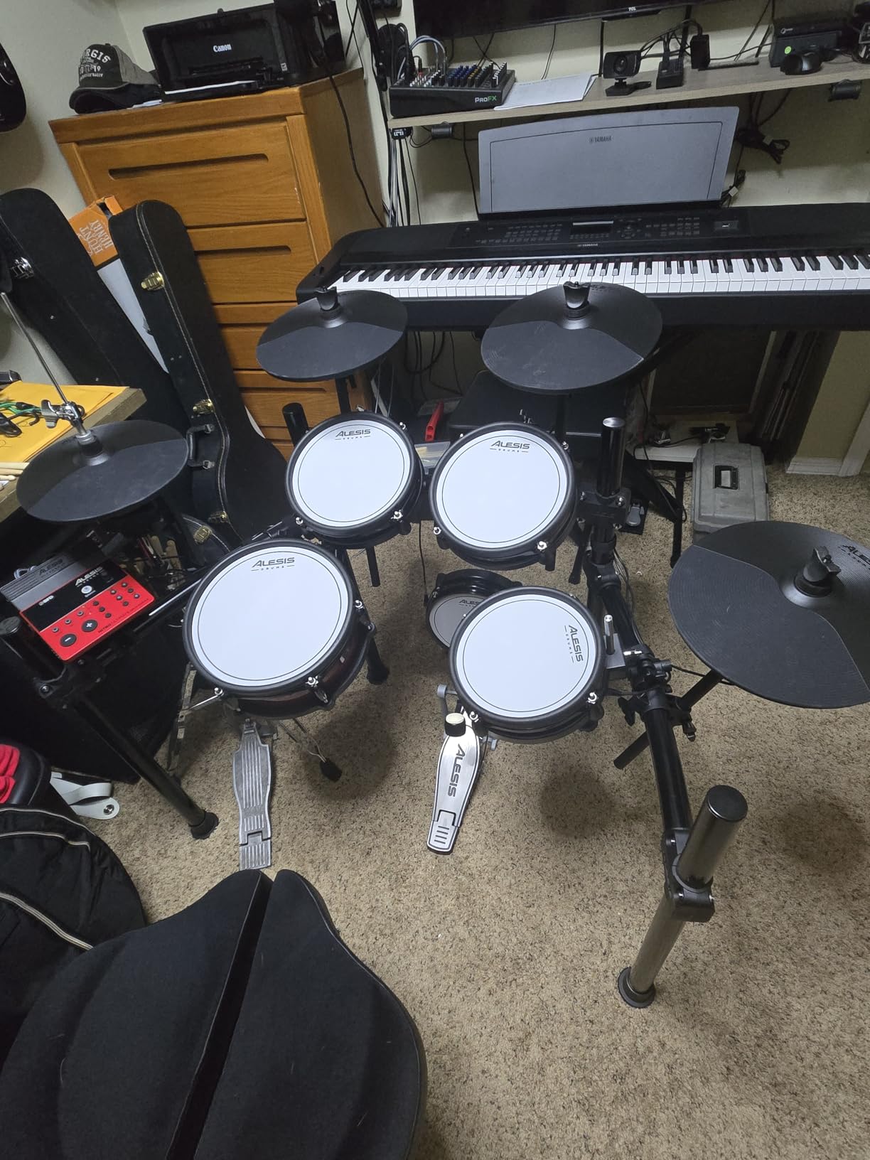 Alesis Nitro Ultimate Electric Drum Set | 10