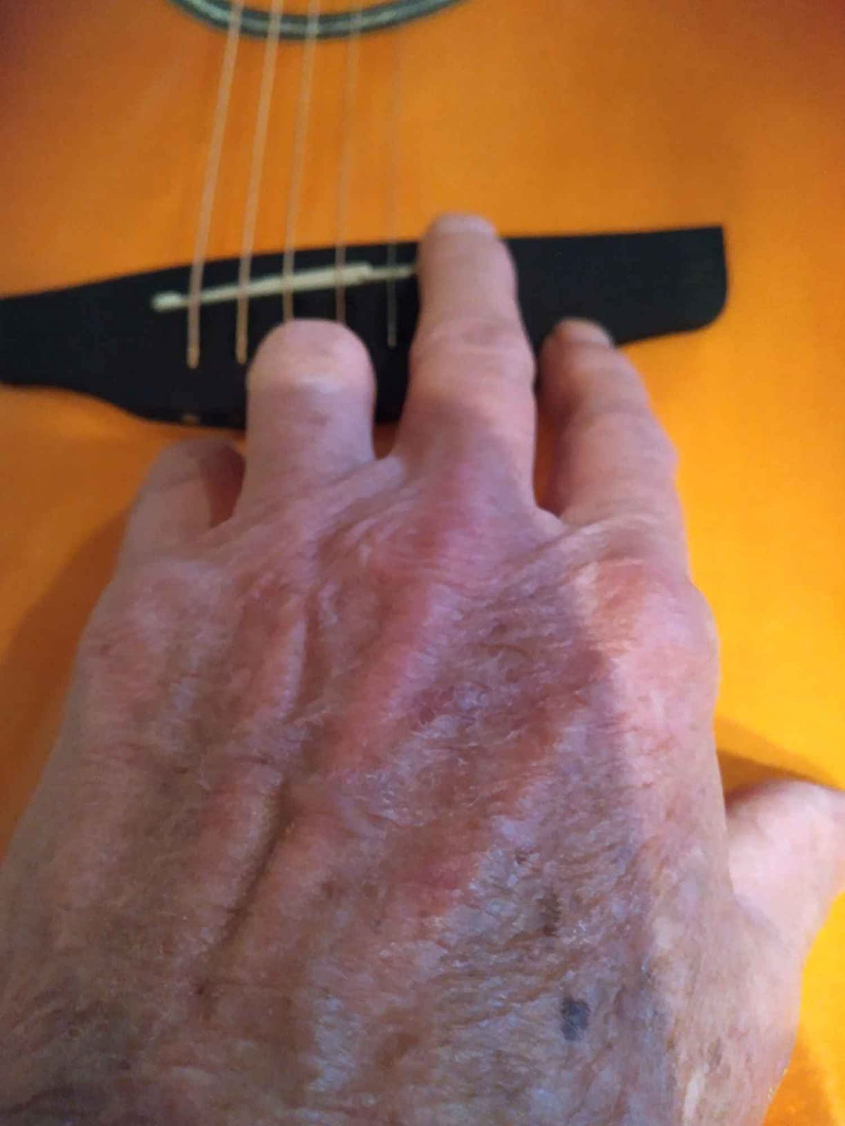 Ovation Applause Standard 6 String Acoustic-Electric Guitar, Right Mid-Depth, Ruby Red AB24II-RR customer photo 2
