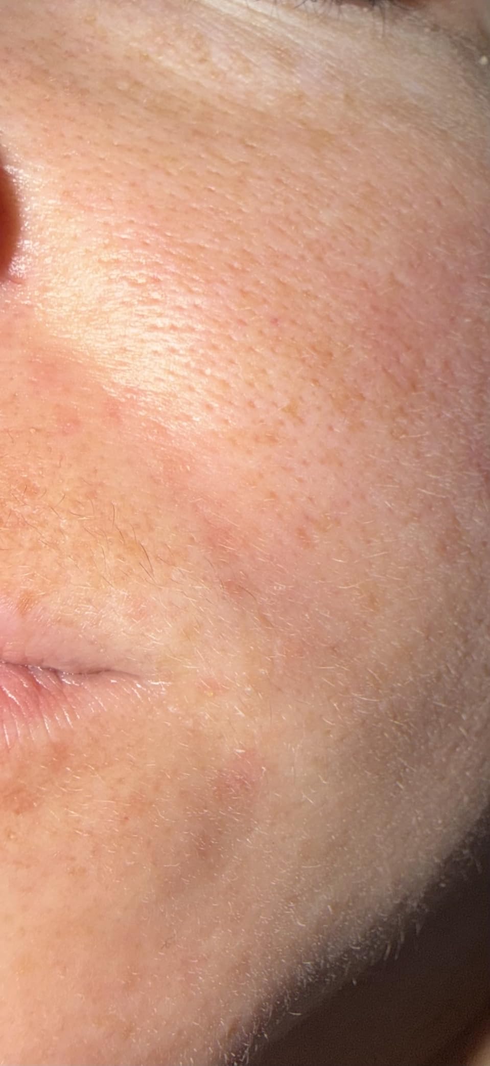 Paula's Choice 2% BHA customer photo 2