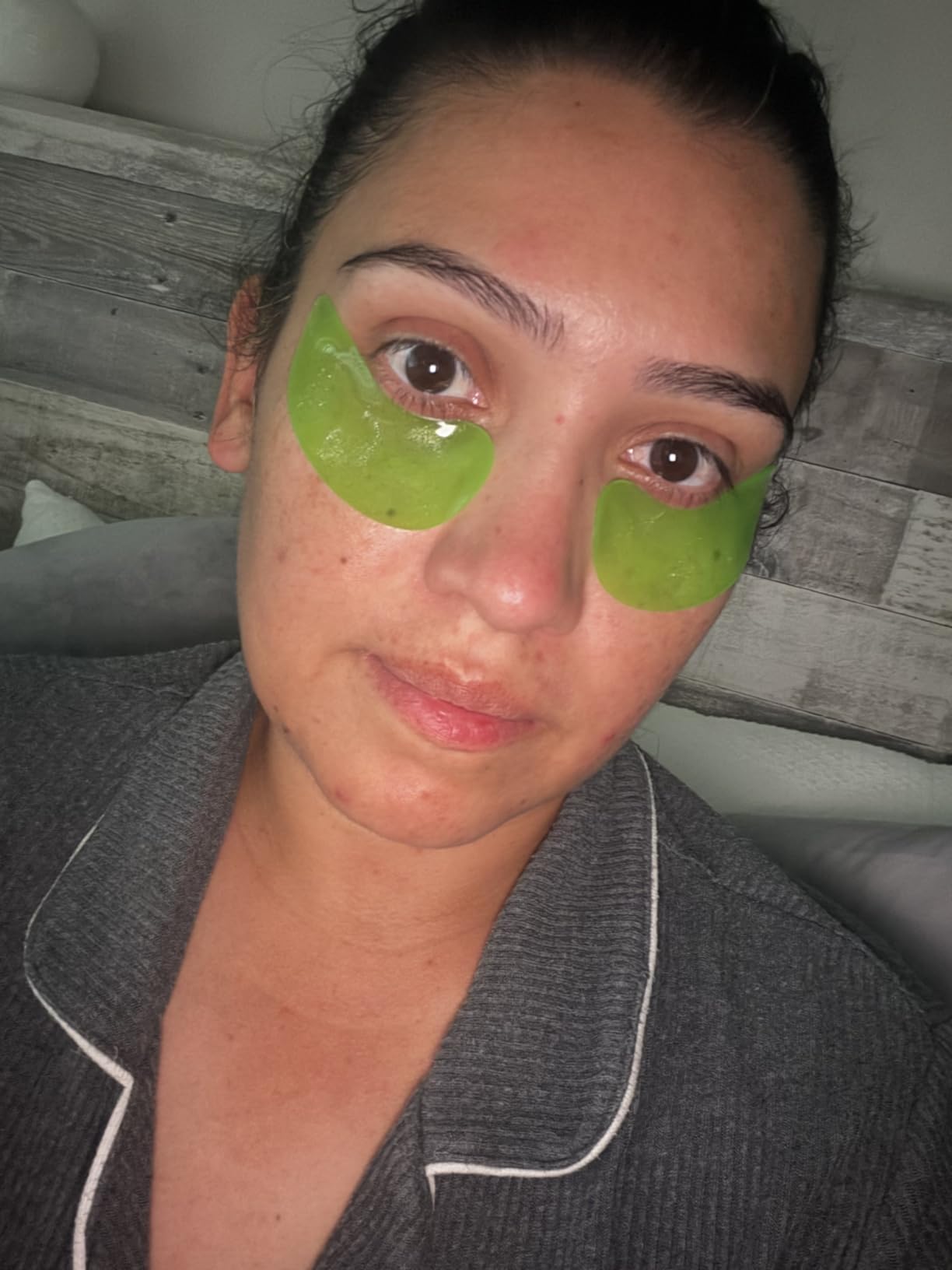 PEAUAMIE Under Eye Patches customer photo 1