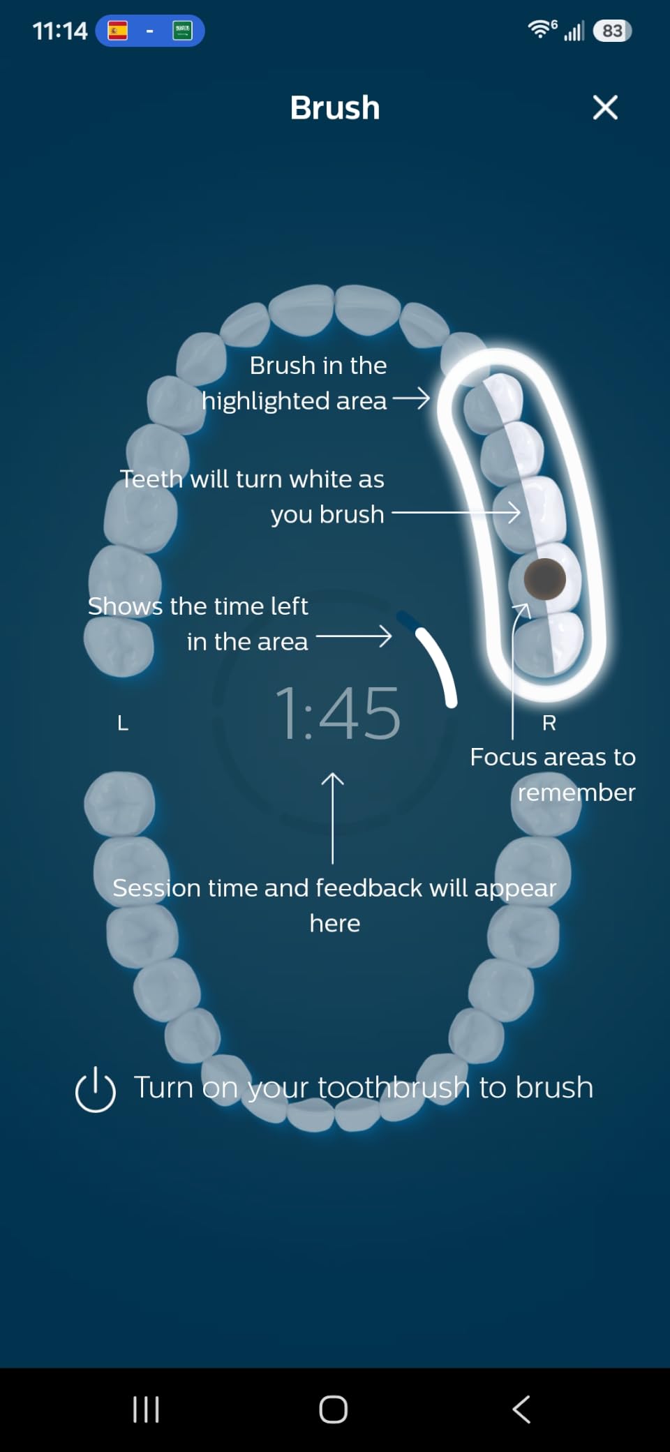 Philips Sonicare DiamondClean 9500 Electric Toothbrush 3 Brush Heads, Black customer photo 2