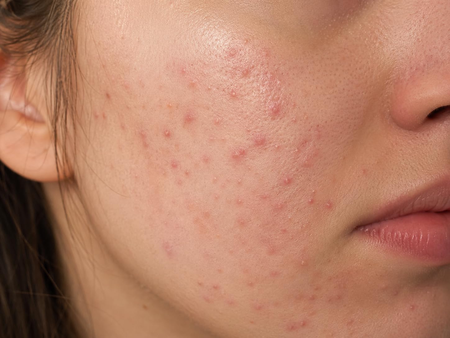 The Ordinary Glycolic Acid Toner customer photo 2